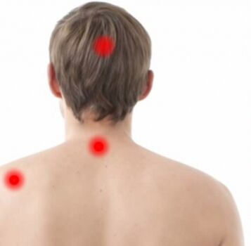 Fokat e osteokondrozës