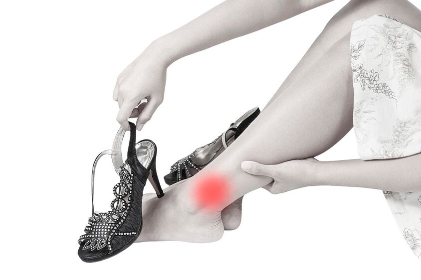 dhimbje në kyçin e këmbës për shkak të artrozës