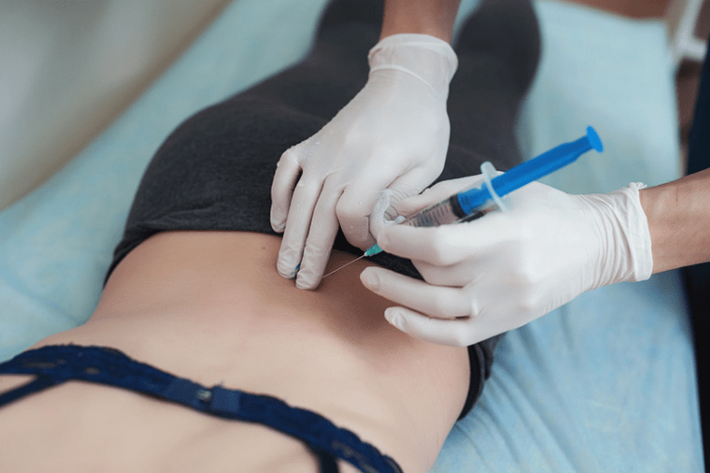 bllokadë në osteokondrozën lumbare